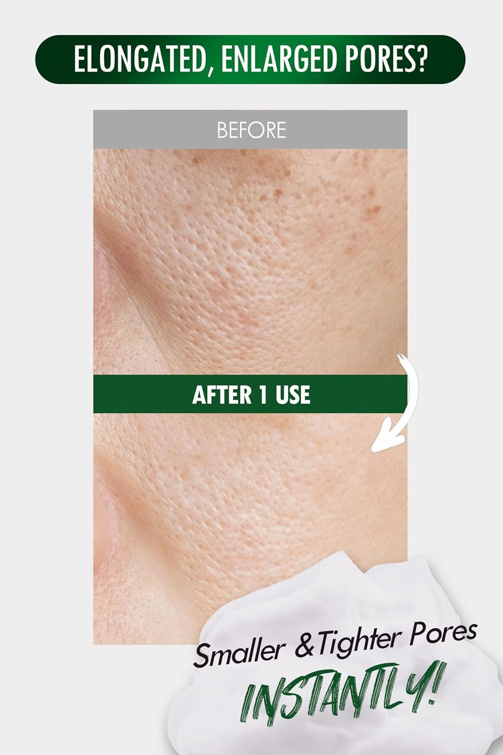 [K-Beauty] Neogen Dermalogy Pore Zero Peeling Mousse | All-in-One Foaming Exfoliating Face Wash Visibly Firming, Tightening & Lifting Skin 3.38 fl oz