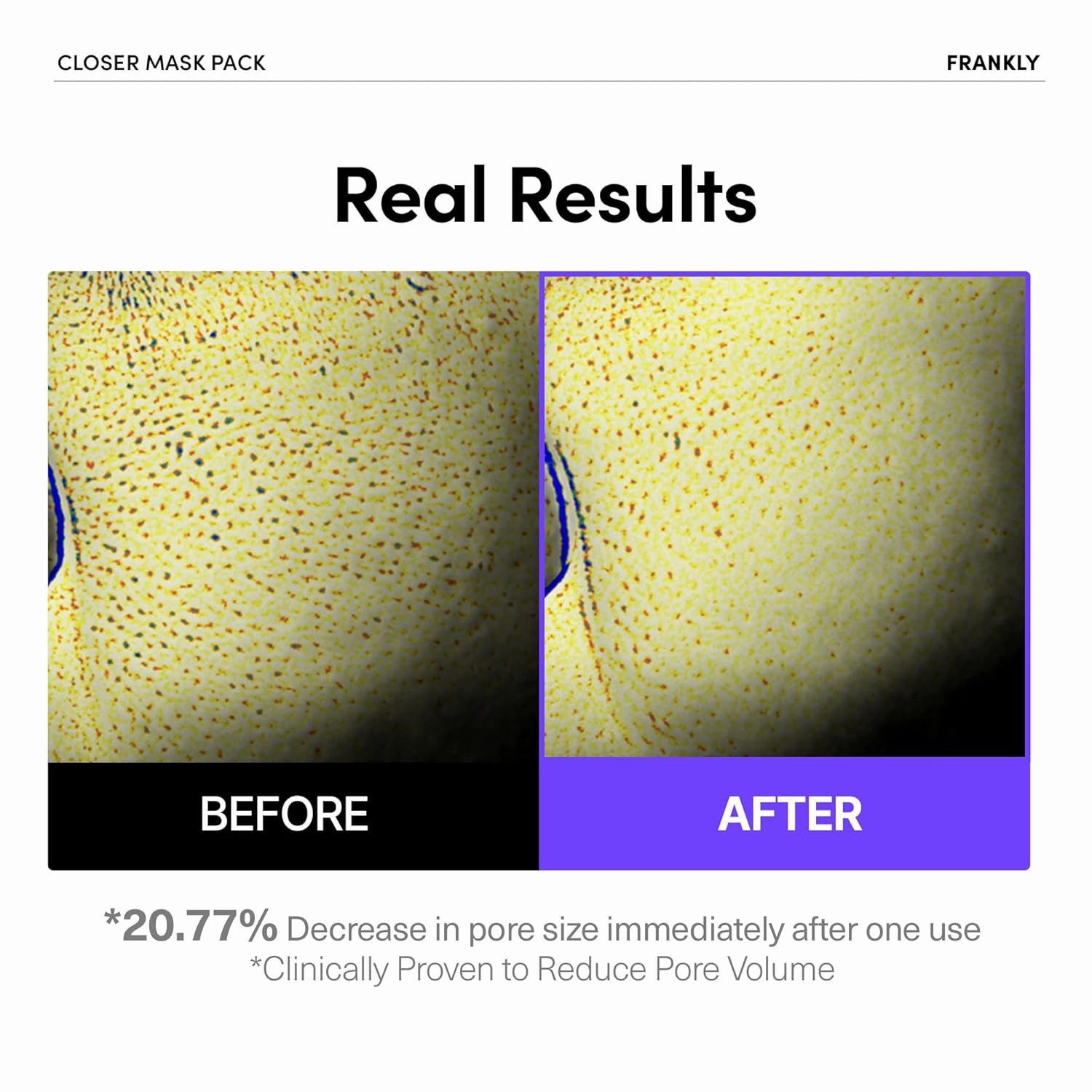 FRANKLY Closer Pore Minimizing Mask,10 sheets – Semi-Gel Face Mask for Pore Care & Firming | Non-sticky, Lightweight | Korean Skin Care with Collagen, Hyaluronic Acids & Peptides | 0.74 fl oz*10 EA