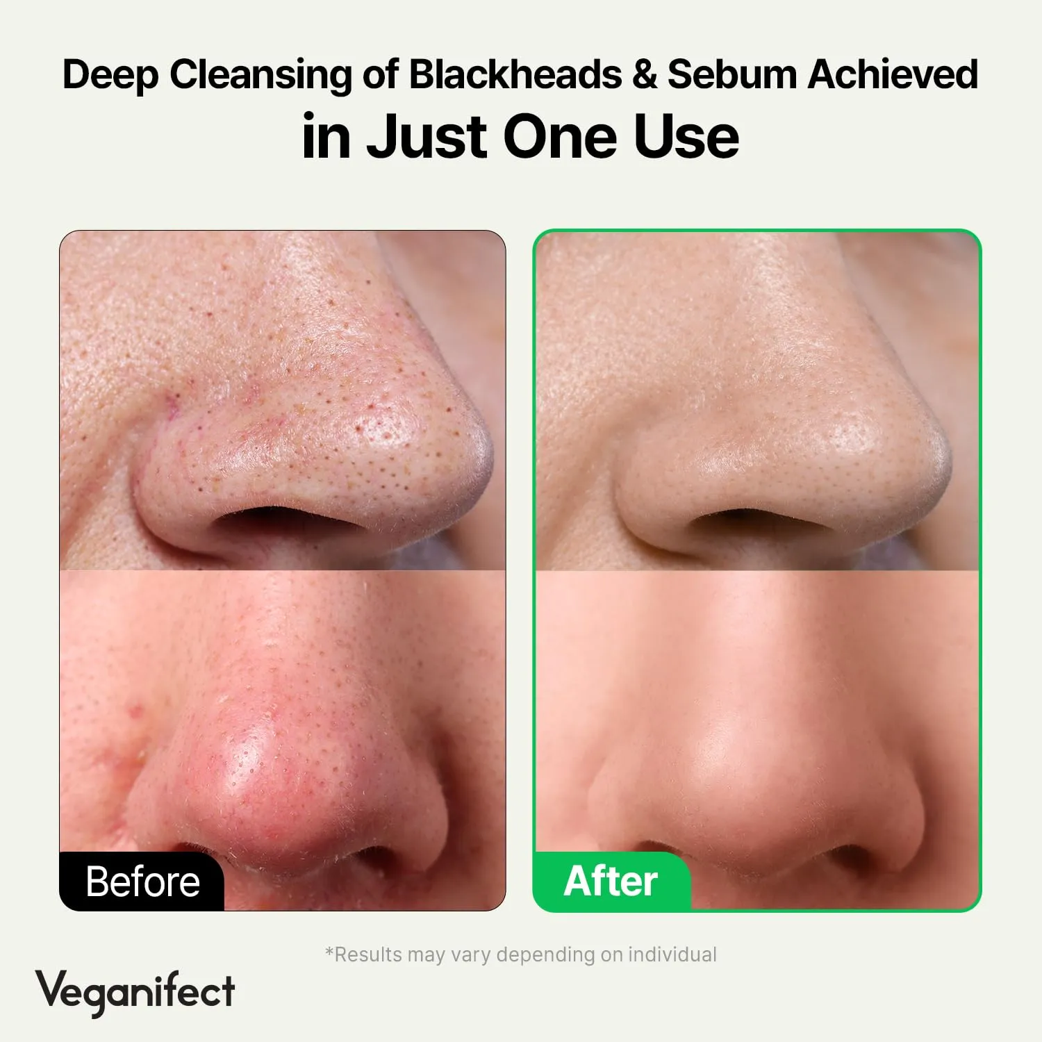 LHA Deep Cleansing Oil, Makeup, Blackhead and Whitehead Remover, Korean Skin Care, Vegan, 6.93 Fl Oz (New)
