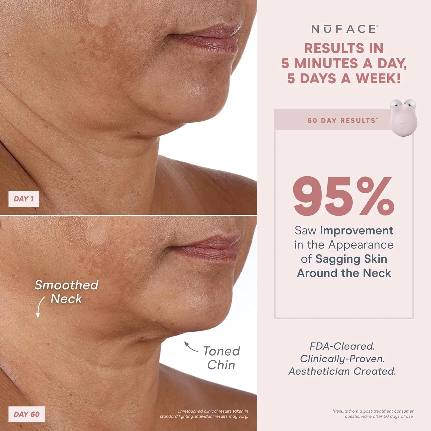 NuFACE MINI  Microcurrent Facial Device Kit - Limited Edition FDA Cleared Face Massager Device   Microcurrent Gel Activator & Applicator Brush - Velvet Rose