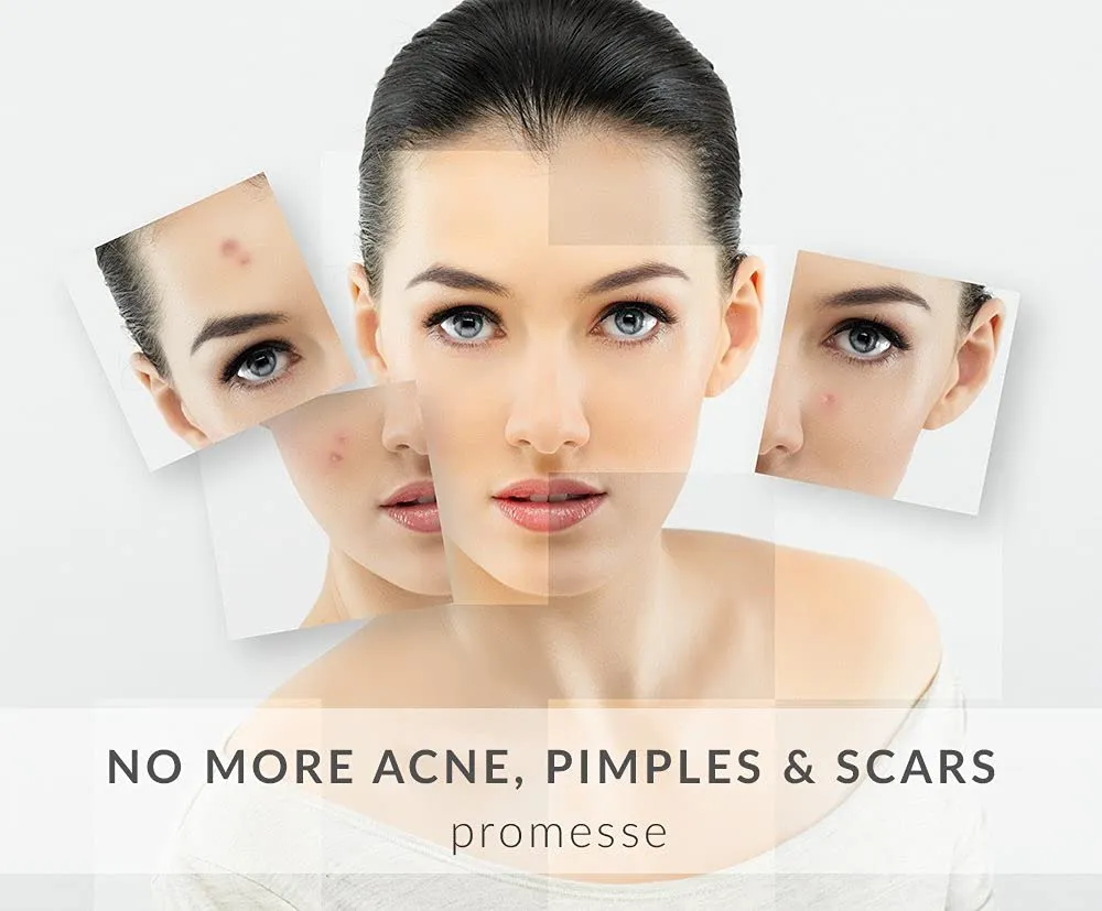 promesse Acne Control Facial Cleanser - Anti-Aging Exfoliating Wash with Glycolic & Salicylic Acid, Rose-Scented, Made in USA, Organic & Natural Ingredients
