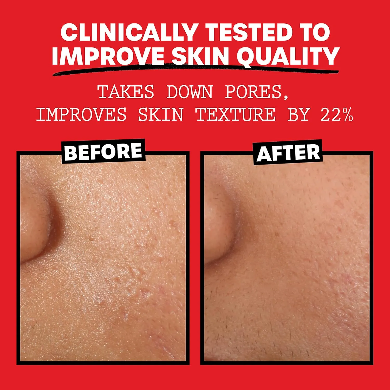Thayers Facial Toner, Witch Hazel with Aloe Vera, Rose Petal, 12 Fl Oz